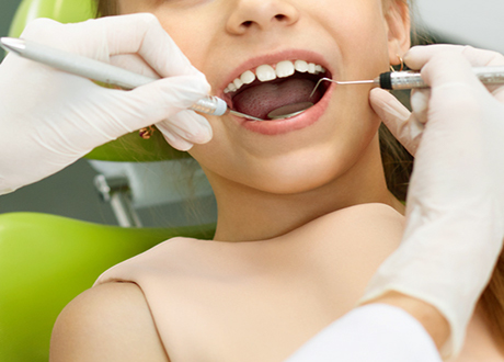 Dental Fluoride Treatment