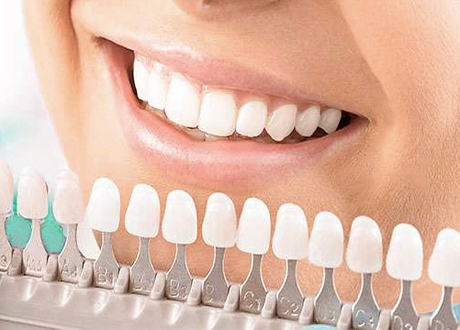 Ceramic Dental Braces